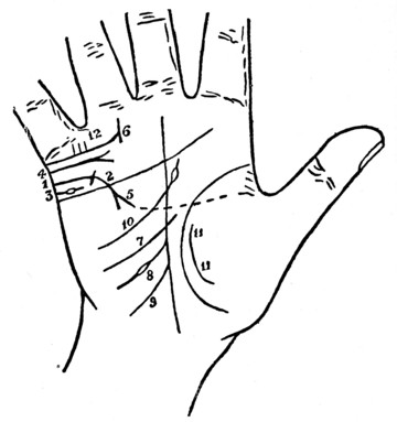 Plate XVIII. MARRIAGE LINES AND INFLUENCE LINES WHICH FURTHER HELP IN DENOTING
MARRIAGE.