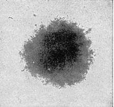 Agar Milk Sugar Culture. Surface Colony of Granule Bacillus from Calf's Stomach