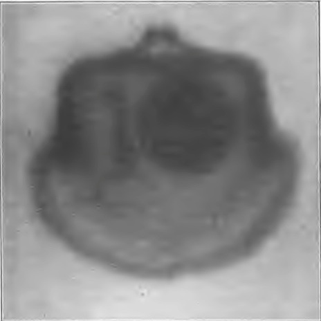 Fig. 11