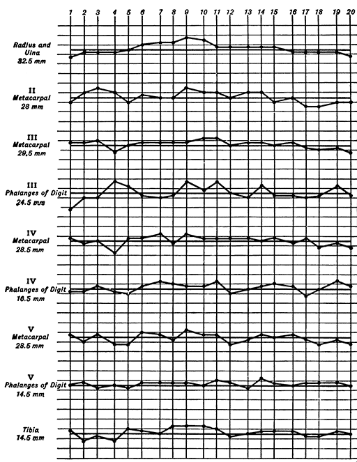 Fig 16.