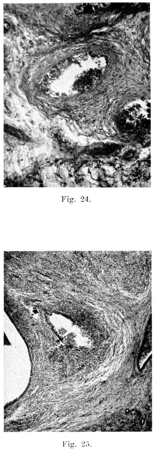 Fig. 24. Fig. 25.